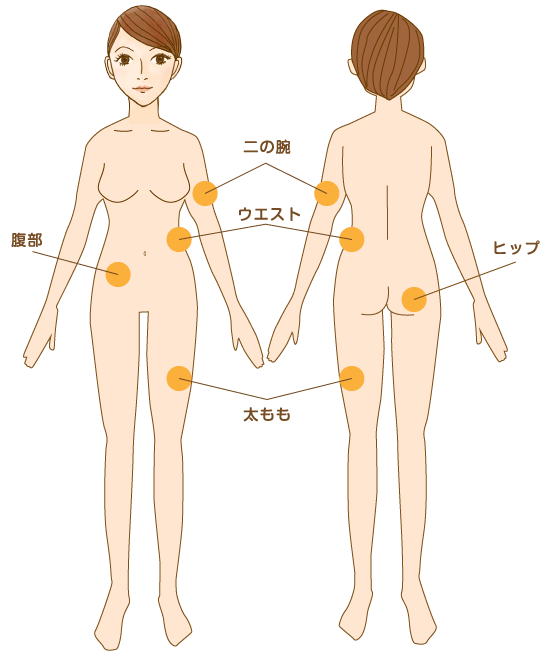 ライポソニック施術可能箇所