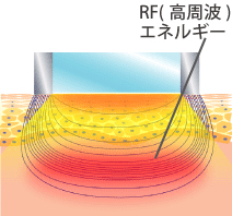 トリニティプラス